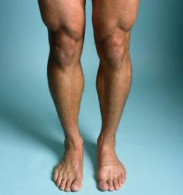 Lesiones de rodillas